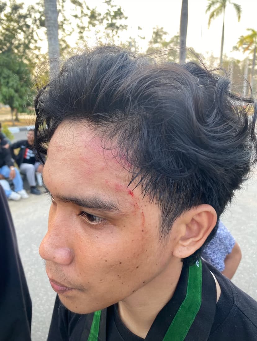 Diduga Arahan GUBERNUR, Kader HMI Dipukul Satpol PP